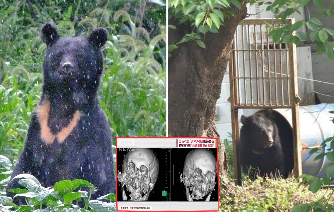 秋田のクマ、70代男性の顔面を骨折させる